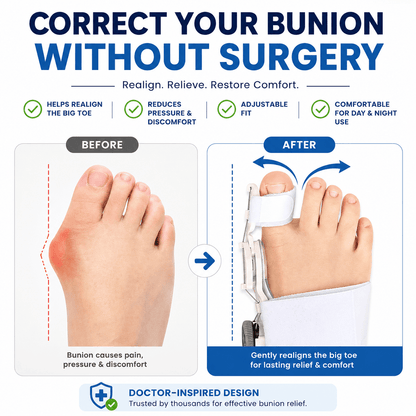 Kallon™ Bunion Corrector Unisex Foot - KALLON